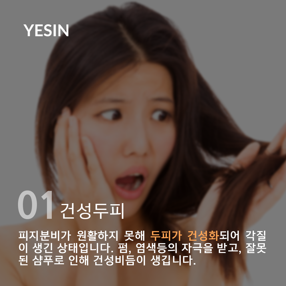 150914-1.png