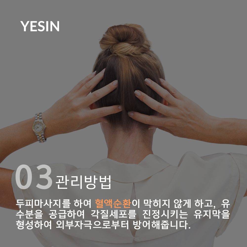 150914-3.png
