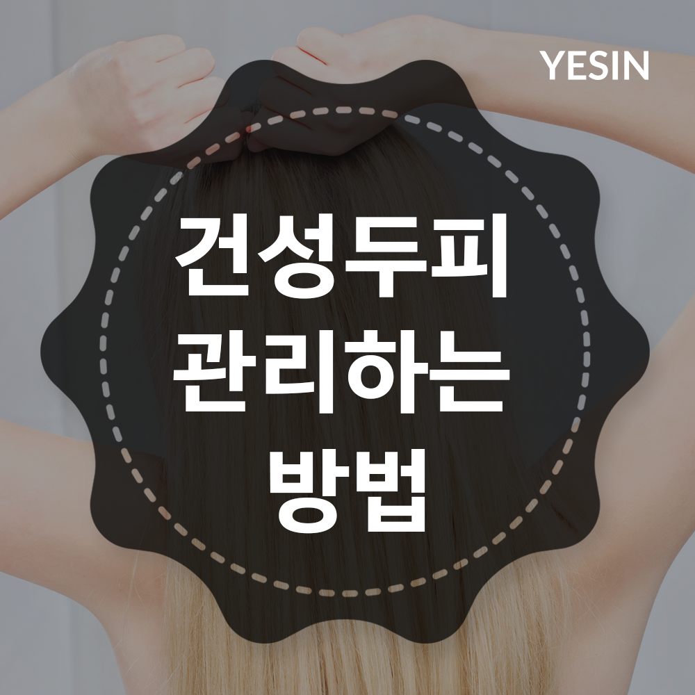 150914-0.png